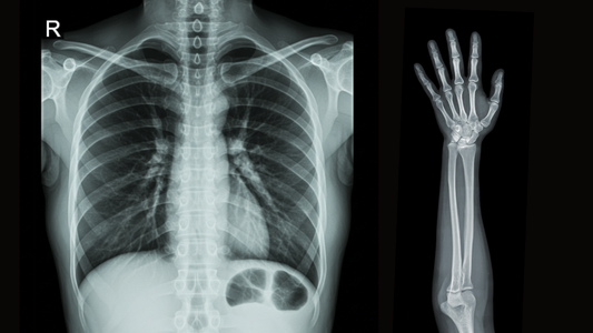 xray